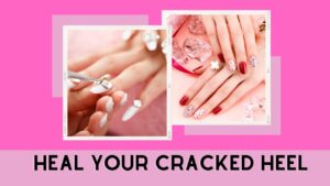 Read more about the article Homemade Cracked Heel Cream Guide to Happy, Healthy Feet